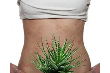 Mayasıl Belirtileri ve Tedavisi